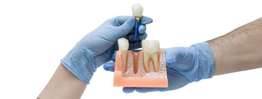 Paura-Impianto-Dentale-Dentista.tv